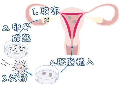 林光渝 院长